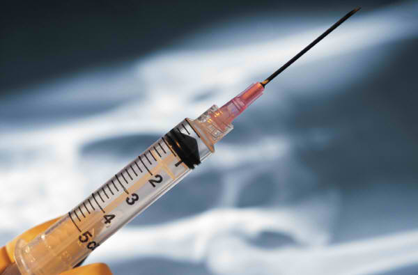 Sur le lien entre vaccination contre l’hépatite B et sclérose en plaques en l’absence de preuve scientifique formelle 